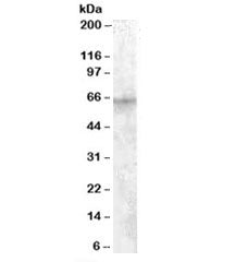 Western blot testing of HepG2 cell lysate with IGF2BP2 antibody at 1ug/ml. Predicted molecular weigh