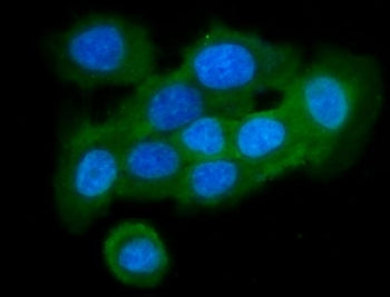 Cystatin B Antibody / CSTB / Stefin B