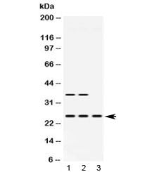 HPRT Antibody