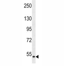 Western blot analysis of ZAK antibody and human HepG2 lysate. There are three isoforms of ZAK, visua