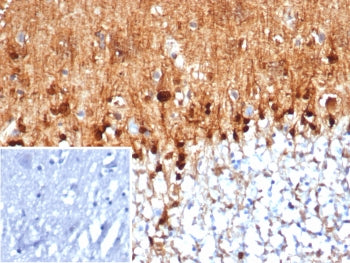 IHC staining of FFPE human brain tissue with S100B antibody (clone S100B/4159) at 2ug/ml. Inset: PBS
