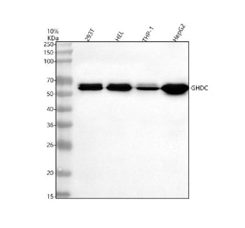 Western blot analysis of GHDC using anti-GHDC antibody. Electrophoresis was performed on a 10% SDS-P