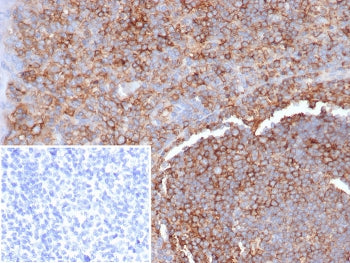 IHC staining of FFPE human tonsil tissue with HLA-G antibody (clone HLAG/7094). Inset: PBS used in p