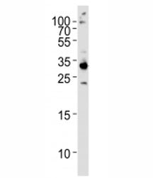Western blot analysis of HeLa lysate and RPS6 antibody used at 1:1000. Predicted molecular weight ~2