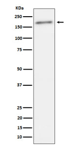 Western blot analysis of Phospho-ErbB2(Y1221 + Y1222) expression in human SKBR3 cell lysate using Ph