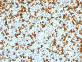 IHC testing of FFPE human tonsil with recombinant PD1 antibody (clone PDCD1/1410R). Required HIER: s
