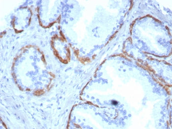 IHC staining of FFPE human prostate tissue with Cytokeratin 14 antibody (clone KRT14/8261R). HIER: b