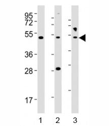 NFKBIE Antibody (IkB epsilon)