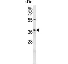 Western blot testing of mouse NIH 3T3 cell lysate with Exonuclease V antibody. Predicted molecular w