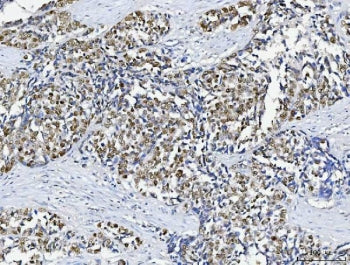 ABL2 Antibody