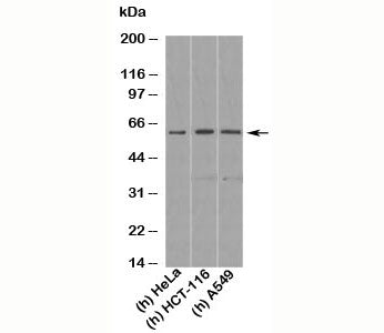 Western blot testing of human samples with KLF4 antibody at 1 ug/ml. Predicted molecular weight: 50-