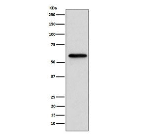 Western blot testing of human MCF7 cell lysate with RARB antibody. Predicted molecular weight ~51 kD