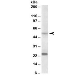 MMP3 Antibody