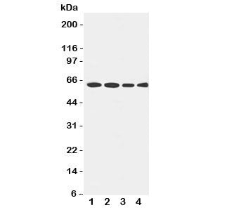 Western blot testing of LCAT antibody and Lane 1: rat brain; 2: U87; 3: HeLa; 4: SMMC-7721 cell lysa