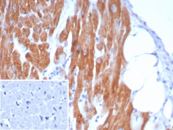 IHC staining of FFPE human heart tissue with Crystallin Alpha B antibody (clone CRYAB/7917). Inset: 