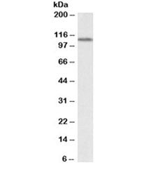 Western blot testing of human kidney lysate with LSD1 antibody at 0.5ug/ml. Expected molecular weigh