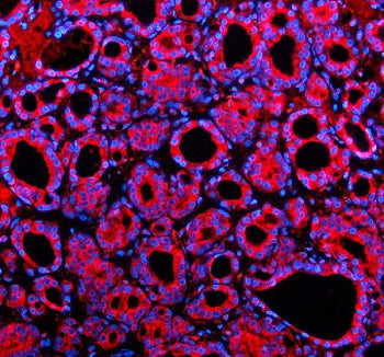 Immunofluorescent staining of SHE using anti-SHE antibody (red). SHE was detected in a paraffin-embe