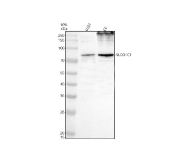Western blot analysis of SLCO1C1 using anti-SLCO1C1 antibody. Electrophoresis was performed on a 10%
