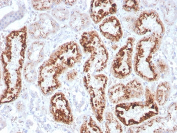 Retinol Binding Protein 4 Antibody / RBP4