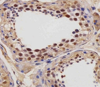 IHC testing of FFPE human testis tissue with IGF2BP1 antibody. HIER: steam section in pH6 citrate bu