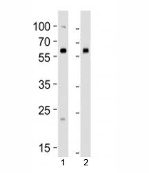 Western blot analysis of lysate from 1) human 293 and 2) mouse NIH3T3 cell line using BMPR1A antibod
