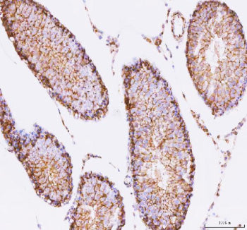 Immunohistochemical staining of STK16 using anti-STK16 antibody. STK16 was detected in a paraffin-em
