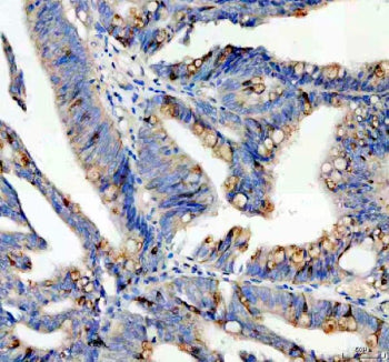 Immunohistochemical staining of SPINK4 using anti-SPINK4 antibody. SPINK4 was detected in a paraffin