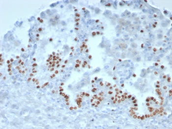 IHC staining of FFPE human lung tissue with NKX2.1 antibody (clone TTF1/8143R). HIER: boil tissue se