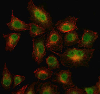 Immunofluorescent staining of WDR26 using anti-WDR26 antibody (green) and anti-Beta Tubulin antibody