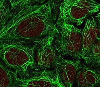 Immunofluorescent staining of methanol-fixed human HeLa cells with Cytokeratin 7 antibody (clone CTK