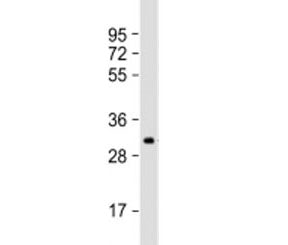 Western blot testing of human SK-OV-3 cell lysate with IGFBP5 antibody at 1:2000. Predicted molecula