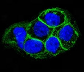Immunofluorescent testing of A431 cells and Alexa Fluor conjugated EGFR antibody (green, clone ERB59