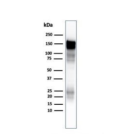 EGF Receptor / EGFR Antibody (cytoplasmic domain)