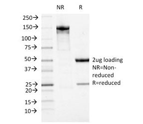 SDS-PAGE analysis of purified, BSA-free ATRX antibody (clone 23c) as confirmation of integrity and p