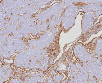 IHC staining of FFPE human uterus tissue with CD34 antibody (clone HPCA1/4393R). HIER: boil tissue s