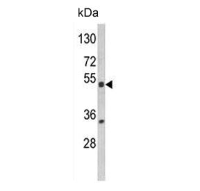 Western blot testing of human HL60 cell lysate with PXR antibody. Predicted molecular weight ~50 kDa