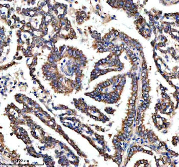 Immunohistochemical staining of RASAL3 using anti-RASAL3 antibody. RASAL3 was detected in a paraffin