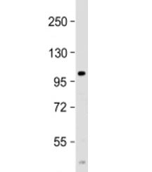 Western blot testing of human spleen lysate with PARP10 antibody at 1:2000. Predicted molecular weig