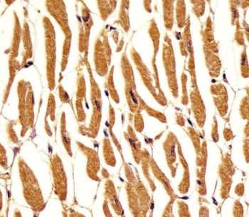 IHC testing of FFPE human heart tissue with Phosphoglucomutase 1 antibody. HIER: steam section in pH