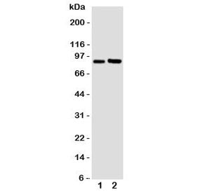 Western blot testing of FGFR3 antibody and Lane 1: U87; 2: SGC cell lysate. Predicted molecular weig