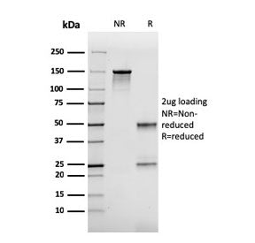 SDS-PAGE analysis of purified, BSA-free FABP2 antibody (clone CPTC-FABP2-3) as confirmation of integ
