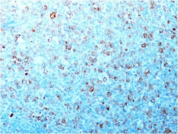 IHC testing of formalin-fixed, paraffin-embedded human tonsil with CDC2 antibody (CDK1/873). Stainin
