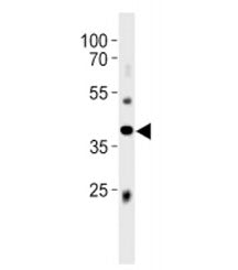 Abi3 antibody western blot analysis in mouse liver tissue lysate. Predicted molecular weight ~39 kDa.