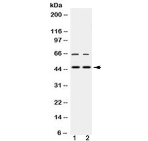 MPI Antibody / Mannose Phosphate Isomerase