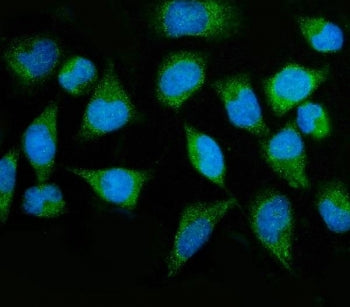 MTMR2 Antibody / Myotubularin-related protein 2