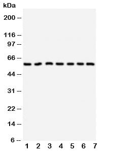 Western blot testing of CYP11B1 antibody and Lane 1: HeLa; 2: U87; 3: MM231; 4: PANC; 5: MM453; 6: H