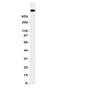 Western blot testing of DNA PKcs antibody and HeLa cell lysate. Predicted/observed size ~460KD