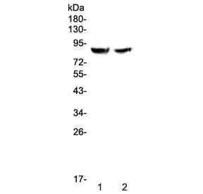 Western blot testing of human 1) HK-2 and 2) 293T cell lysate with Pendrin antibody at 0.5ug/ml. Pre