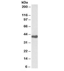 Western blot testing of Jurkat lysate with CDK7 antibody at 0.3ug/ml. Predicted molecular weight: ~3