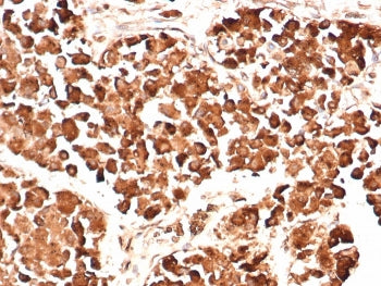 Synacthen Antibody / ACTH